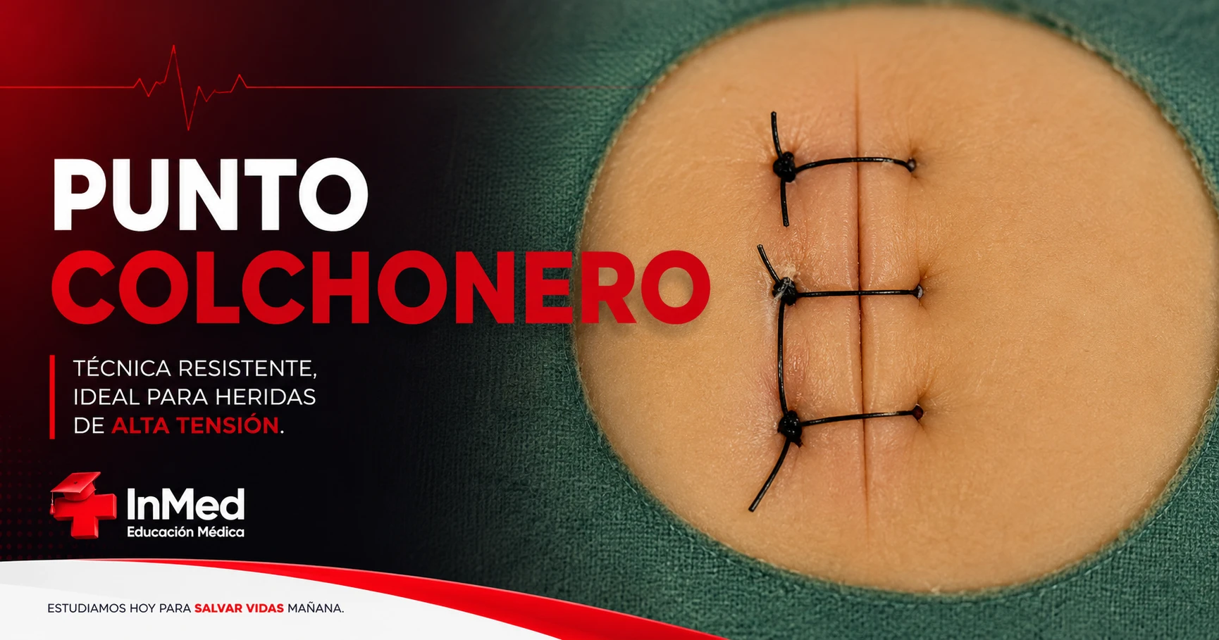 Punto colchonero: guía para estudiantes